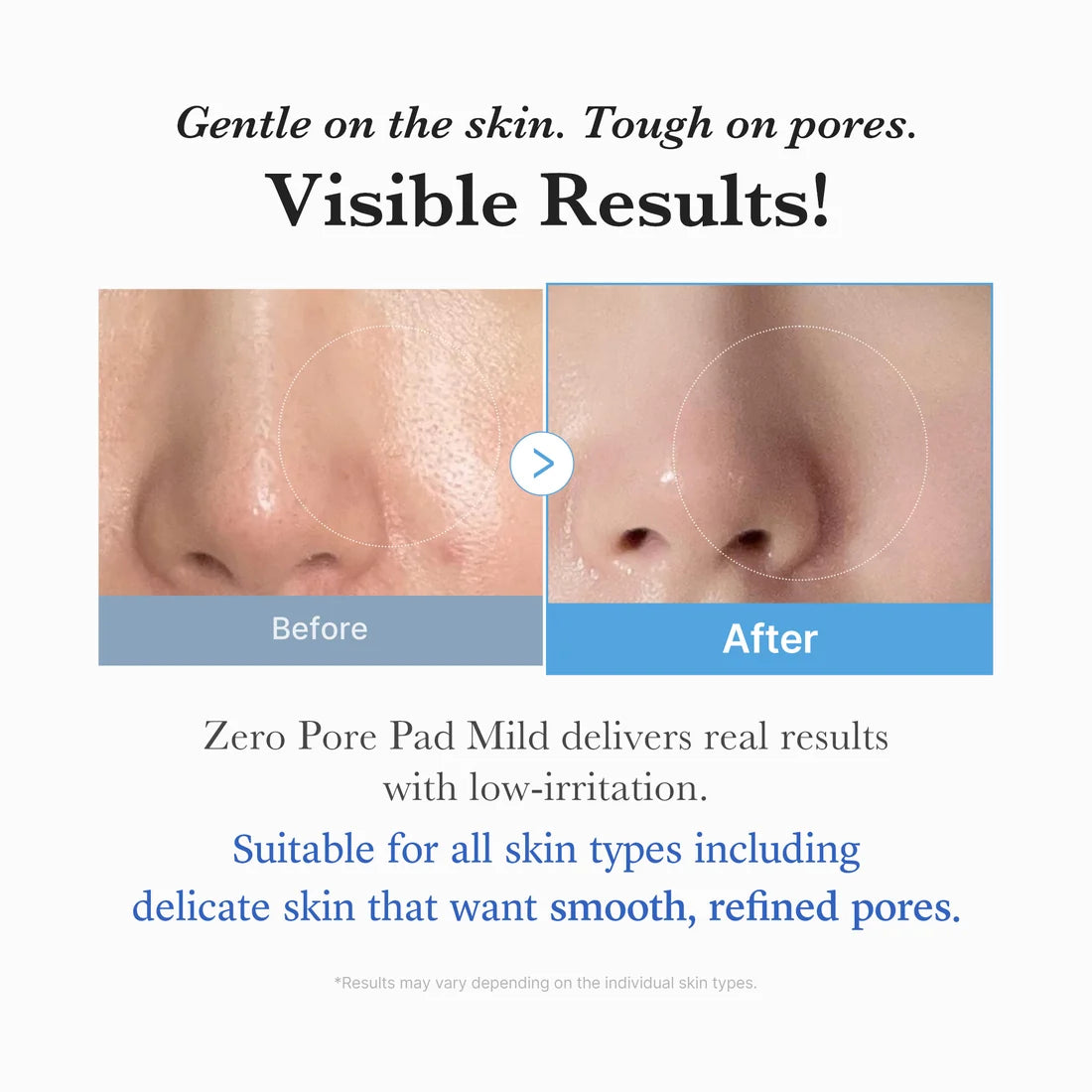 Zero Pore Pads Mild - Medicube
