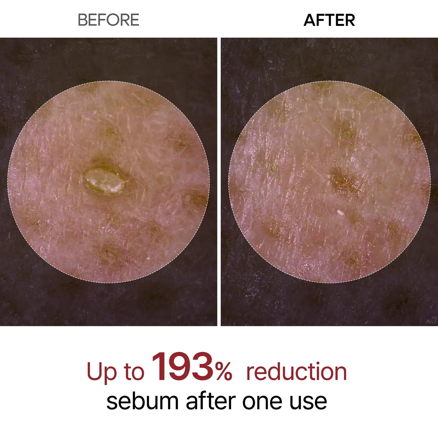Peel Shot Glow Black Rice Ampulle - Dr.Melaxin