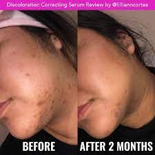 Good Molecules Discoloration Correcting Serum 30 ml