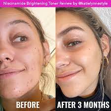 Good Molecules Niacinamide Brightening Toner
