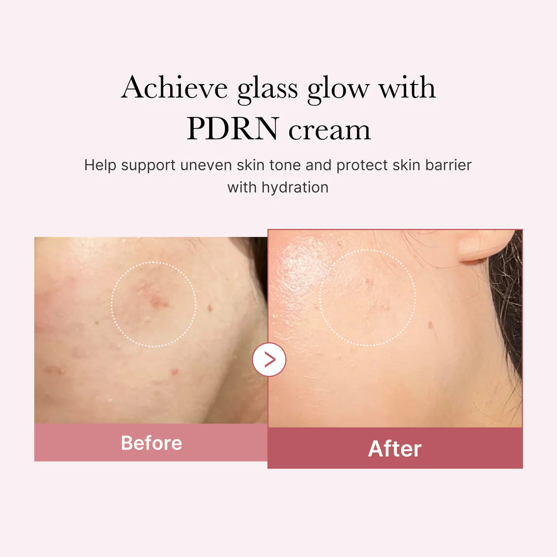 PDRN Pink Hyaluronic Moisturizing Cream - Medicube