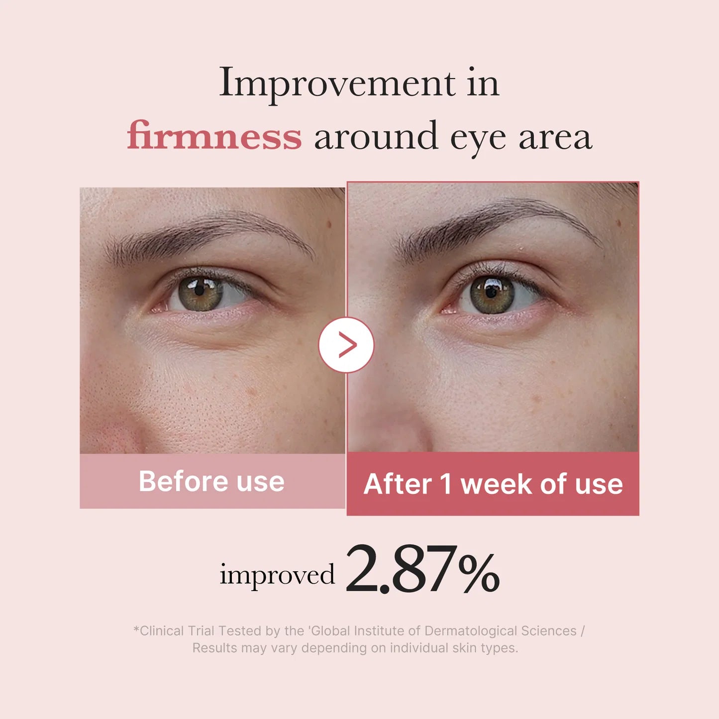 Medicube - Pink Peptide Eye Cream