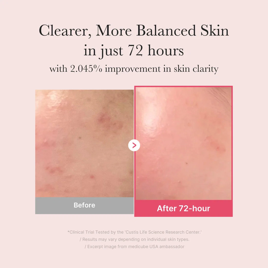 TXA Niacinamide Serum - Medicube