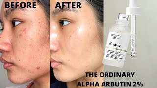 The Ordinary Alpha Arbutin 2% HA